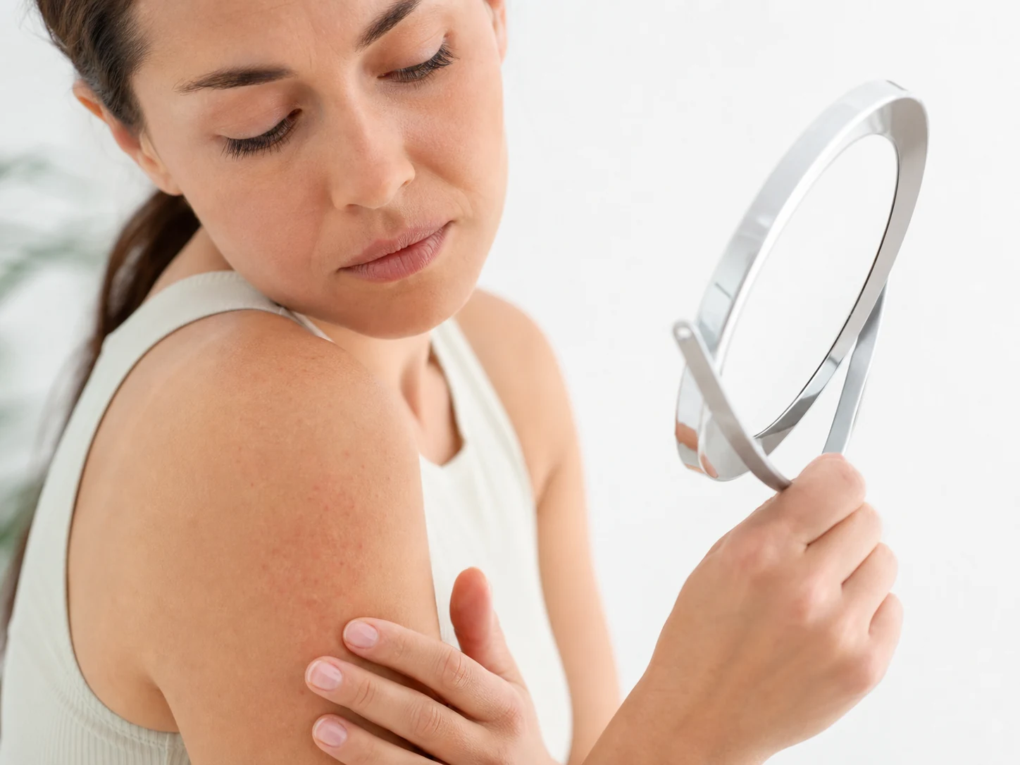Comparison of heat rash with similar-looking skin conditions